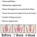 AnnieCare PinkMarine Fish Oil Softgel Capsules - Soothe&Slim Anti-Itch Detox Slimming (2box/14pcs) - Buy Online on GoSupps.com