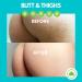 Acne Clearing Lotion for Butt, Back, Bum & Thigh - Special Treatment Formula for Pimples, Ingrown Hairs, Razor Burn, Blackheads & Blemishes - Vegan & Cruelty Free - Buy Online on GoSupps.com