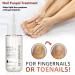 Nail Growth and Strengthening Serum 20ml Nails Repair Serum Fungal Nail Treatment for Toenail Extra Strong Toenail Growth Treatment for Repairing Damaged and Discolored Nails Improve Onychomycosis - Buy Online on GoSupps.com