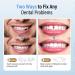 Fake Teeth Repair Kit - 60pc White Temporary Fix for Missing & Broken Teeth - Buy Online on GoSupps.com