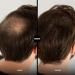Vegan Scatter Hair for Compression | Zinc-Enriched Bulk Hair | High-Quality Light Brown (30g) - Made in Europe - Buy Online on GoSupps.com