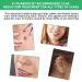 Tobcharm Keloid Scar Removal Gel - Effective Treatment for Piercing Bumps, Stretch Marks, and Surgical Scars | 30g Silicone Gel - Buy Online on GoSupps.com