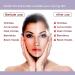 Nutriglow Insta Glow Facial Kit 6-Pieces Skin Care Set with Deep Cleanser Scrub Nourishing Gel Whitening Cream Mask Pack and Serum Acne Prone Tan Treatment for Bright Skin 250 gm + 10 Ml - Buy Online on GoSupps.com