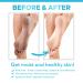 Ellocy 42% Urea Gel with Salicylic & Hyaluronic Acid - Cracked Heel Repair & Toenail Fungus Treatment - Buy Online on GoSupps.com