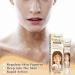  MagiSel Cream to repair white spots and pigmentation disorders hypoallergenic skin cream and pigment gel for skin with white spot disease promotes an even skin tone. - Buy Online on GoSupps.com