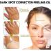 Exfoliating Acanthosis Peeling Oil Exfoliation Body Oil Peeling Solution Skin Peel Dark Spot Corrector Oil Yellow Peeling Oil Body Skin Care Exfoliation Oil Dark Spot Remover For Body Hand Feet - Buy Online on GoSupps.com