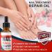 WERPOWER Extra Strong Fungal Nail Treatment for Discoloured Toenails - Effective Relief for Damaged and Infected Nails - Buy Online on GoSupps.com