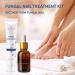 Fungal Nail Treatment Kit - Stop Fungus & Restore Healthy Toenails - Buy Online on GoSupps.com