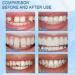 Temporary Tooth Filling Repair Kit - DIY Dental Repair Granules for Broken Teeth - Buy Online on GoSupps.com
