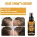 Hair Thickening Serum Spray with Biotin - Set of 5 for Stronger Healthier Hair Growth | Enhance Length & Volume - Buy Internationally - Buy Online on GoSupps.com