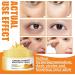 Vitamin C Eye Cream Vitamin C Anti-Ageing Eye Moisturiser Anti-Fatigue Eye Cream for a Radiant Complexion - Buy Online on GoSupps.com