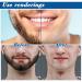 DMNQ 12 Pcs Mach 3 Razor Blades - Proglide Compatible for Beard & Leg Hair | International Shipping Available - Buy Online on GoSupps.com