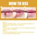 Bee Lip Balm Set: Hydrating Honey Pot Lip Mask with Propolis for Dry, Cracked Lips - 2 Pcs - Buy Online on GoSupps.com