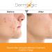 Acne Treatment Control Pads with Salicylic, Glycolic & Lactic Acid - Clears Pores, Oily Skin & Breakouts. Removes Dark Spots & Pimples - Buy Online on GoSupps.com