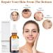 Retinol 1% In Squalane 30ml Retinol Serum for Face & Hyaluronic Acid Serum for Face Anti Aging Serum for Face Brightening Face Serum for Women Reduce Fine Lines Wrinkles Vegan Skincare - Buy Online on GoSupps.com