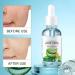 Rust sheet essence liquid aloe essence liquid moisturizing aloe essence liquid deeply replenishes water lightens and nourishes the skin fades acne marks - Buy Online on GoSupps.com
