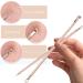 Blackhead Remover Pimple Popper Tool Kit - Professional Acne Extractor Set for Face & Nose - Blemish Whitehead Extraction Tools in Rose Gold Case - Buy Online on GoSupps.com