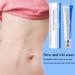 Scar gel Cream against stretch marks 30g Care Gel For Burns Injuries Keloid Surgical Face Neck Hands Body All Types of Scars - Buy Online on GoSupps.com