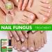 15ml Keratin 3 Days Growth Nail Treatment&Strengthener Nail Growth Treatment for Nail Repair Nail Strengthener for Damaged Nails Extra Strong Growth Nail Polish Nail Oil Treatment for Damaged Nails - Buy Online on GoSupps.com