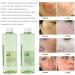 Hydra Dermabrasion Solution Moisturizing 4 Piece Peeling Hydro Solution Skin Tightening for Salon - Buy Online on GoSupps.com