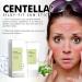 Centella Sunscreen SPF 50+ PA++++ Centella Calming Daily Facial Sun Lotion Korean Centella No White Cast Light-Weight Korean Sunscreen Skincare(60G) - Buy Online on GoSupps.com