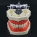 Articulated Dental Typodont Model with 28 Removable Teeth - Kilgore Nissin | Ideal for Teaching & Study - International Shipping Available - Buy Online on GoSupps.com