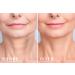 UNDOMIEL Womens Smoothing Anti Wrinkle Scars Care Rose essence Chest Pads Medical Treatment Neck Pads Prevent Stretch Reduces Fine Lines when Sleeping. (Natural Rose Essence) - Buy Online on GoSupps.com
