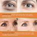 Vitamin C Eye Cream Stick Glow Eye Stick Eye Cream for Dark Circles and Puffy Eyes Under Eye Cream for Women/Men Eye Cream Anti Aging Eye Balm Stick Cooling & Hydrating Skincare 1 - Buy Online on GoSupps.com
