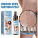 Shantou Youjia Variant Veins Spray Cream against spider veins and vein care fade cream spray against spider vein for radiant skin Skin Revealing and Care for Varicose Veins Location care spray 30 ml - Buy Online on GoSupps.com