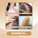 shampoo Hair Regrowth Shampoo Solid Shampoo for Hair Anti Hair Loss Shampoo Anti Dandruff Solid Shampoo Bar for Women Men - Buy Online on GoSupps.com