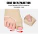 Effective Bunion Corrector - Hallux Valgus Correction Sleeve & Toe Separator - 2 Pairs for Foot Care - Buy Online on GoSupps.com