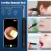 NANANARDOSO Wireless Ear Wax Removal Camera with 1080P HD Endoscope Otoscope - 6 LED Lights, 6 Ear Spoons, Compatible with iPhone, iPad, Android Phones - Buy Online on GoSupps.com