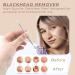 OCBA Blackhead Remover Professional Skincare Spot Treatment Blackhead Remover Tool for Blemish Comedone Whiteheads Pimple Popper with Double Sided Soft Touch and Anti-Slip Design - Buy Online on GoSupps.com