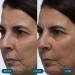 ELEMIS Pro-Collagen Skin Future Supplements - Reduce Fine Lines & Wrinkles Support Hydration & Elasticity - 60 Capsules | International Shipping Available - Buy Online on GoSupps.com