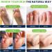 Tea Tree Foot Soak Callus Remover Gel - Extra Strength Callus Remover Gel & Foot Soak With Epsom Salts For Calluses Dry Cracked Heels Toenail Fungus & Odor - Pedicure for Tired Feet - Buy Online on GoSupps.com