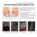 Women's Bunion Corrector & Toe Separator Set - Gel Toe Spacers for Pain Relief & Pressure Prevention (6-Pack) - Buy Online on GoSupps.com