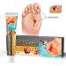 KXC Decubitus Treatment Cream 20g - Relief for Pressure Sores (4 pcs) - Buy Online on GoSupps.com