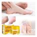 Toenail Treatment Cream & Foot Cream for Cracked Heels - Deep Moisturizing & Daily Care (1g Pack) - Buy Online on GoSupps.com