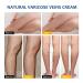 TASVAM Varicose Veins Cream - Treatment for Legs, Relief Spider Veins, Strengthen Capillaries for Improved Circulation - Buy Online on GoSupps.com