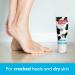 Udderly Smooth Shea Butter Foot Cream 8 oz Tube (Pack of 2) - Deeply Moisturizing for Rough, Dry Skin - Buy Online on GoSupps.com