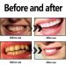Natural Charcoal Teeth Whitening Powder with Coconut - Remove Yellow Spots & Lighten Teeth - Buy Online on GoSupps.com