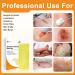 Carbou Medical Xeroform Petrolatum Dressing 5x9 - 25 Pack, Non-Adherent Gauze Pads for Wound Care & Surgical Incisions - Buy Online on GoSupps.com