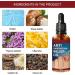 Ingrow Toenail Correction Treatment Oil Ingrown Toenail Correction Drops Cuticle Care Oils for Ingrown Toenails Nail Care and Treatment Ingrown Toenail Drops Ingrowing Toenail Treatment 10ML - Buy Online on GoSupps.com