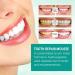 Bright Whitening Teeth Mousse - Herbal Oral Repair for Fresh Breath & Gum Health | Deep Cleaning Toothpaste (1PC) - Buy Online on GoSupps.com
