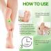 Lukmlca Bee Venom Foot Patch Lukmlca Bee Venom LymphaticDrain Age Slimming Foot Patch Lukmlca Bee Venom Lukmlca Bee Venom Lymphatic Drainage Foot Pads for Sleep Better & Relieve Stress (1 Box) - Buy Online on GoSupps.com