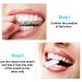 20 Pack Aligner Tray Chewies - Colorful Seaters for Aligner Trays | Light Pink, Red, Green, Lavender, Light Yellow - Buy Online on GoSupps.com