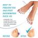 Silicone Toe Separators for Overlapping Toes | Bunion Corrector and Toe Spacers for Hammer Toe | Toe Straighteners for Crooked Toes | 2 pcs Set (White) - for Women and Men - Buy Online on GoSupps.com