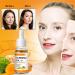 Horuili Turmeric Dark Spot Corrector Serum Turmeric Anti-Oxidant Serum for Skin Lightening Turmeric Essential Facial Oil Deep Moisturizing Face Cream (3pcs) - Buy Online on GoSupps.com