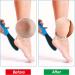 Wllhyf 4-Piece Double-Sided Pedicure Tool Set - Reusable Foot Scrubber for Dead Skin Remover Foot Care for Wet Dry & Cracked Feet - Buy Online on GoSupps.com
