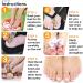 GLAMZA Ingrown Toenail Corrector Clamp - Safe & Effective Treatment Tool - Buy Online on GoSupps.com